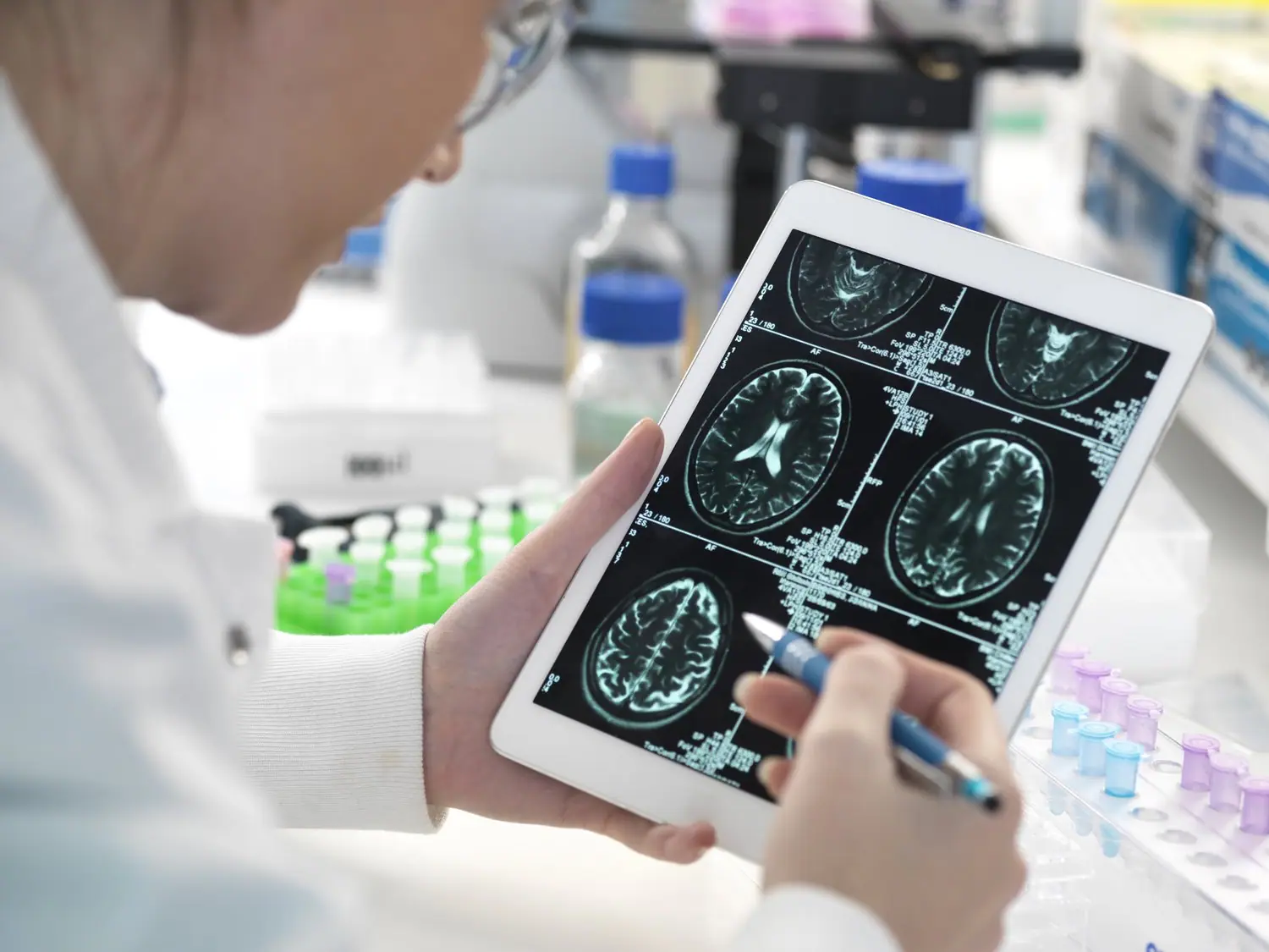 Sztuczna inteligencja w diagnostyce medycznej - wsparcie decyzji lekarskich